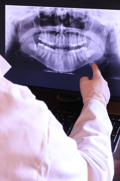 Best Broken Tooth Emergency  in Yosemite Lakes, CA