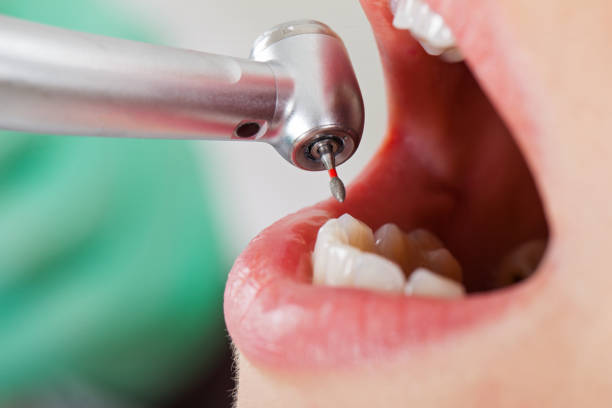 Best Emergency Dentist Near Me  in Yosemite Lakes, CA